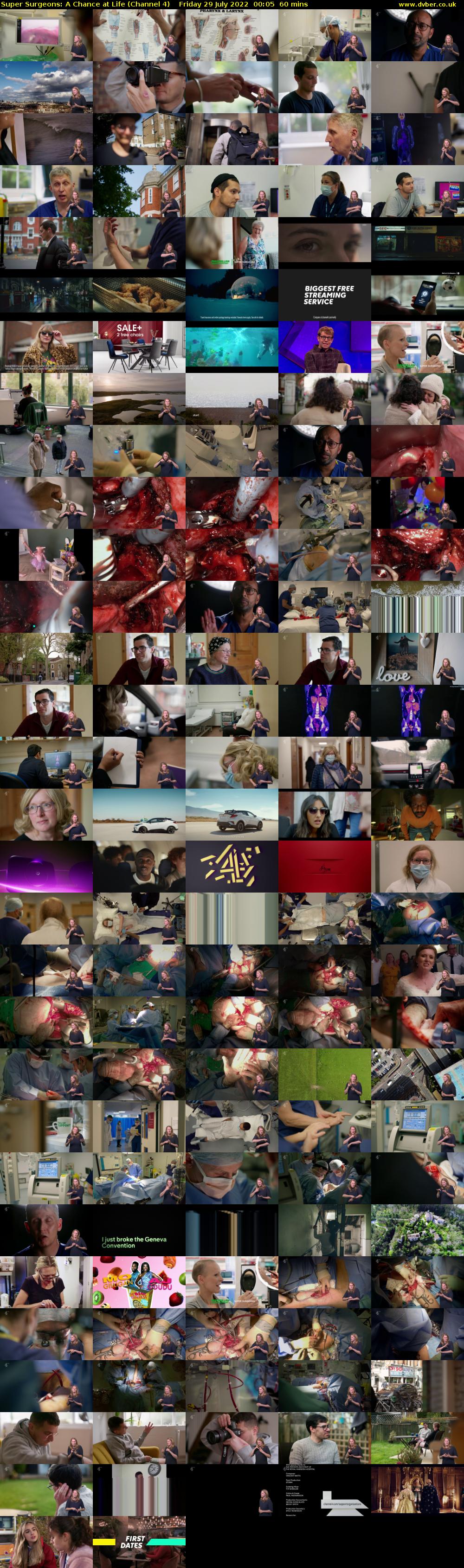Super Surgeons: A Chance at Life (Channel 4) Friday 29 July 2022 00:05 - 01:05