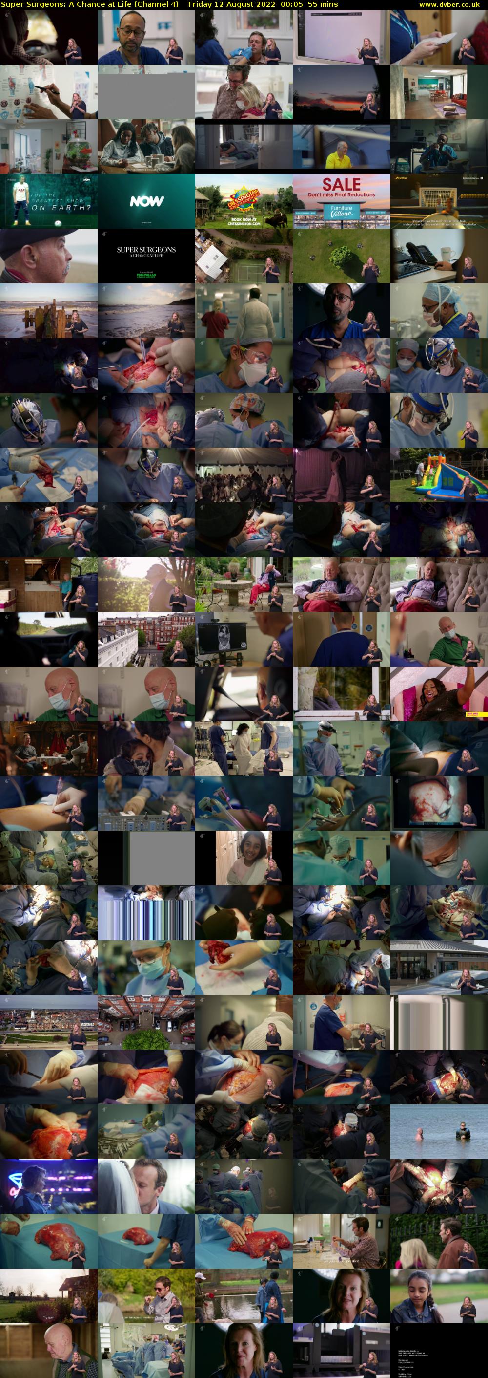Super Surgeons: A Chance at Life (Channel 4) Friday 12 August 2022 00:05 - 01:00