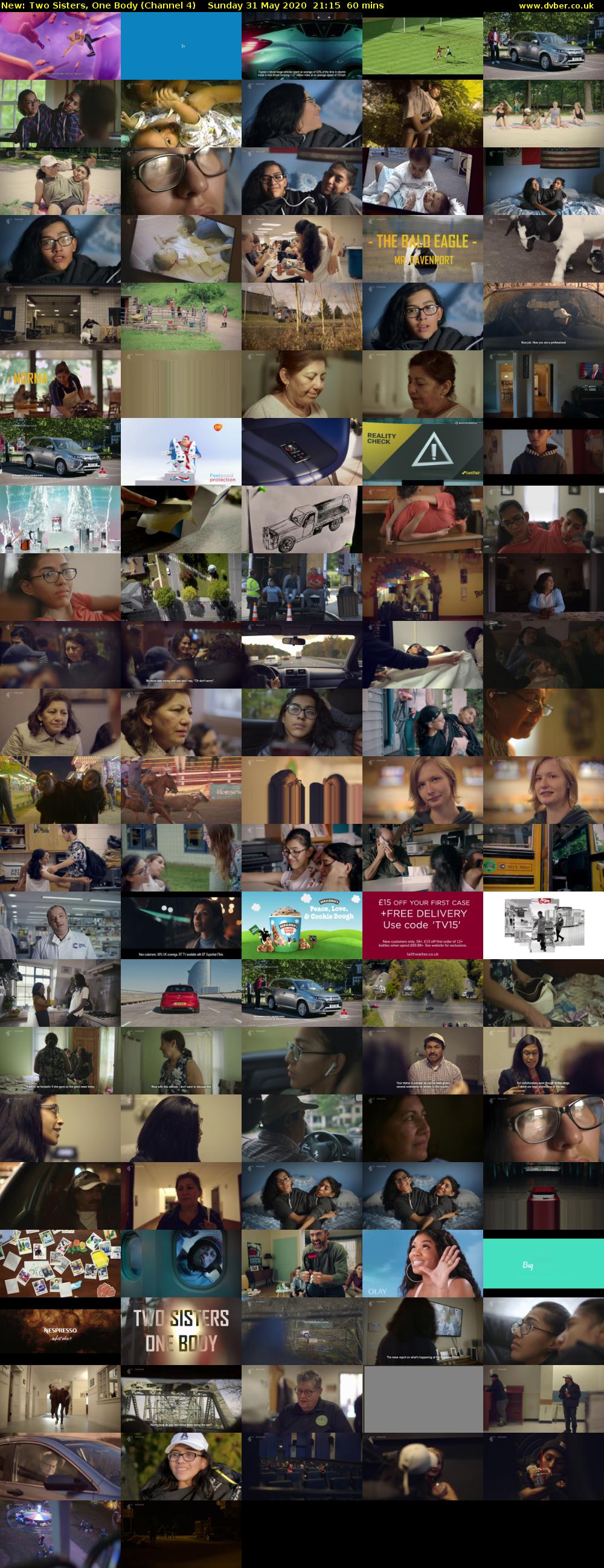 Two Sisters, One Body (Channel 4) Sunday 31 May 2020 21:15 - 22:15