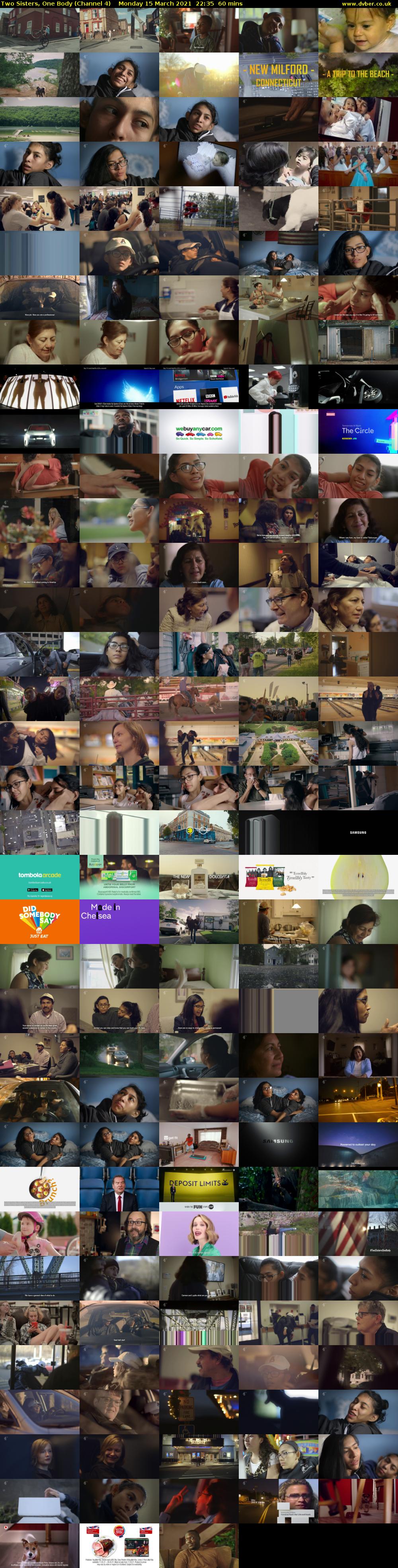 Two Sisters, One Body (Channel 4) Monday 15 March 2021 22:35 - 23:35