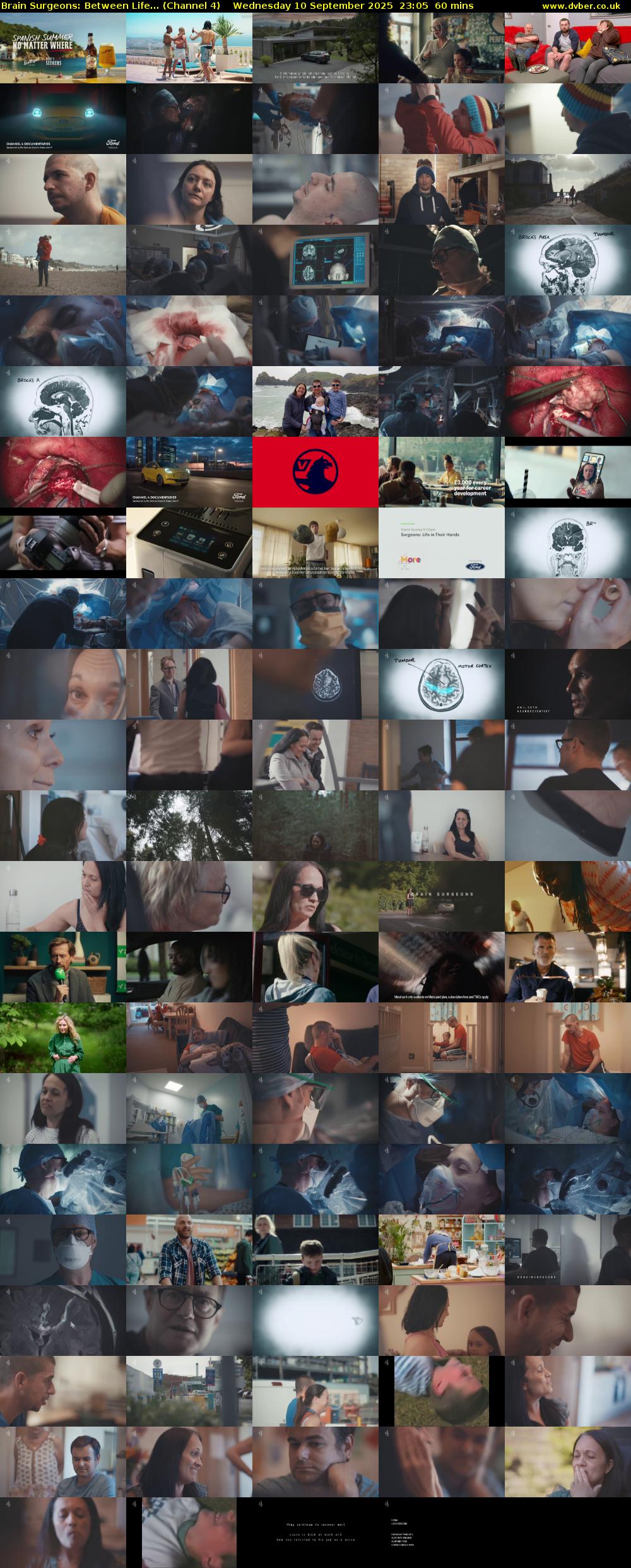 Brain Surgeons: Between Life... (Channel 4) Wednesday 10 September 2025 23:05 - 00:05