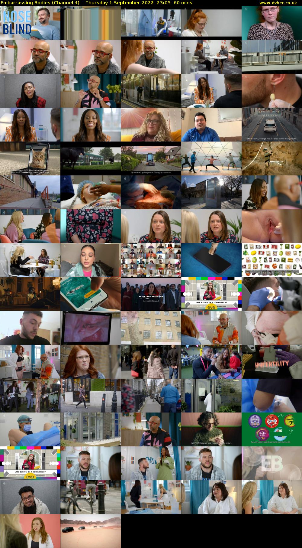 Embarrassing Bodies (Channel 4) Thursday 1 September 2022 23:05 - 00:05