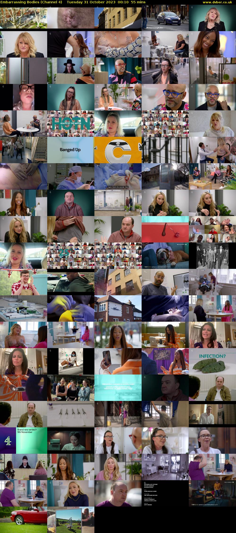 Embarrassing Bodies (Channel 4) Tuesday 31 October 2023 00:10 - 01:05