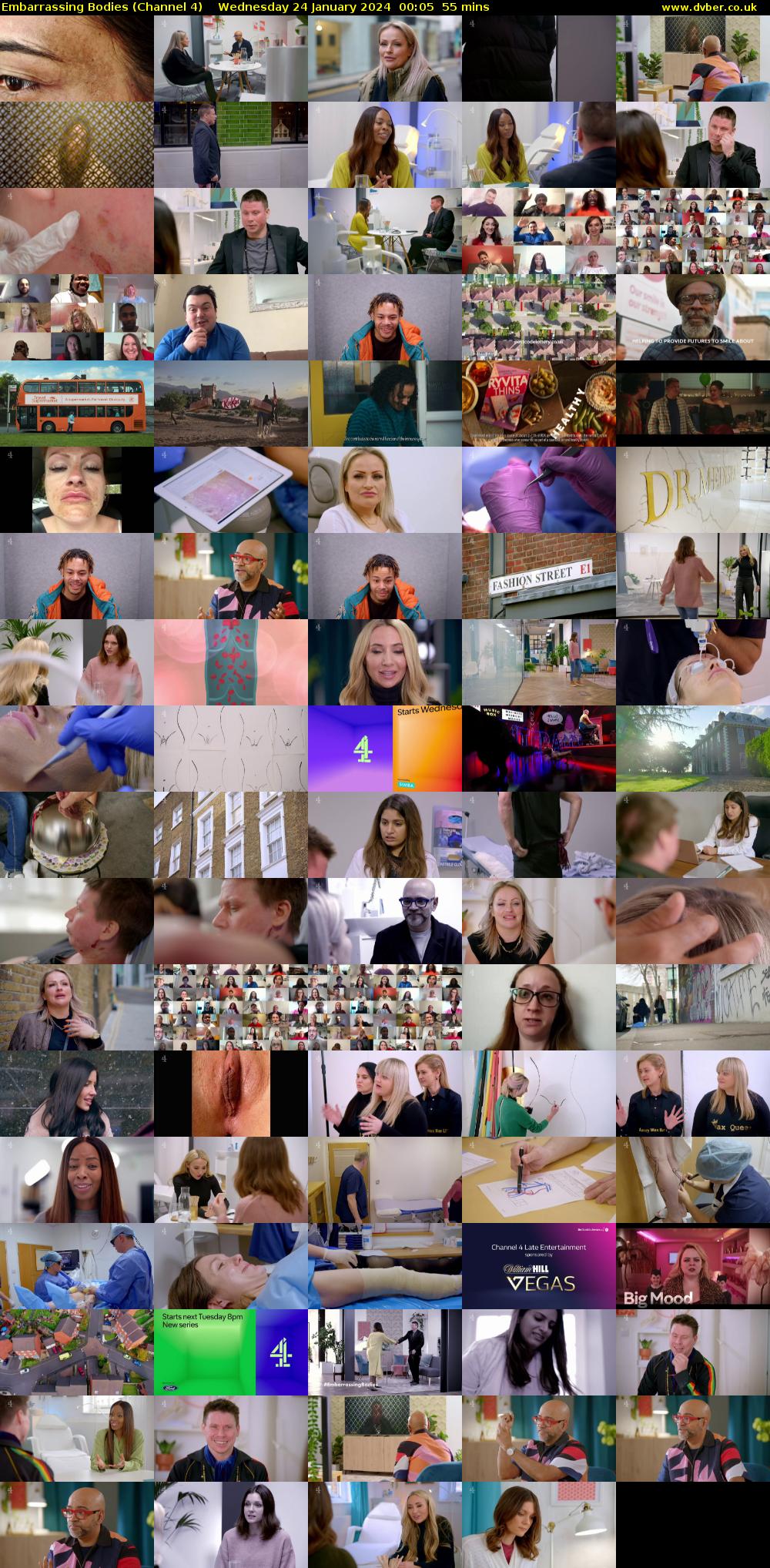 Embarrassing Bodies (Channel 4) Wednesday 24 January 2024 00:05 - 01:00