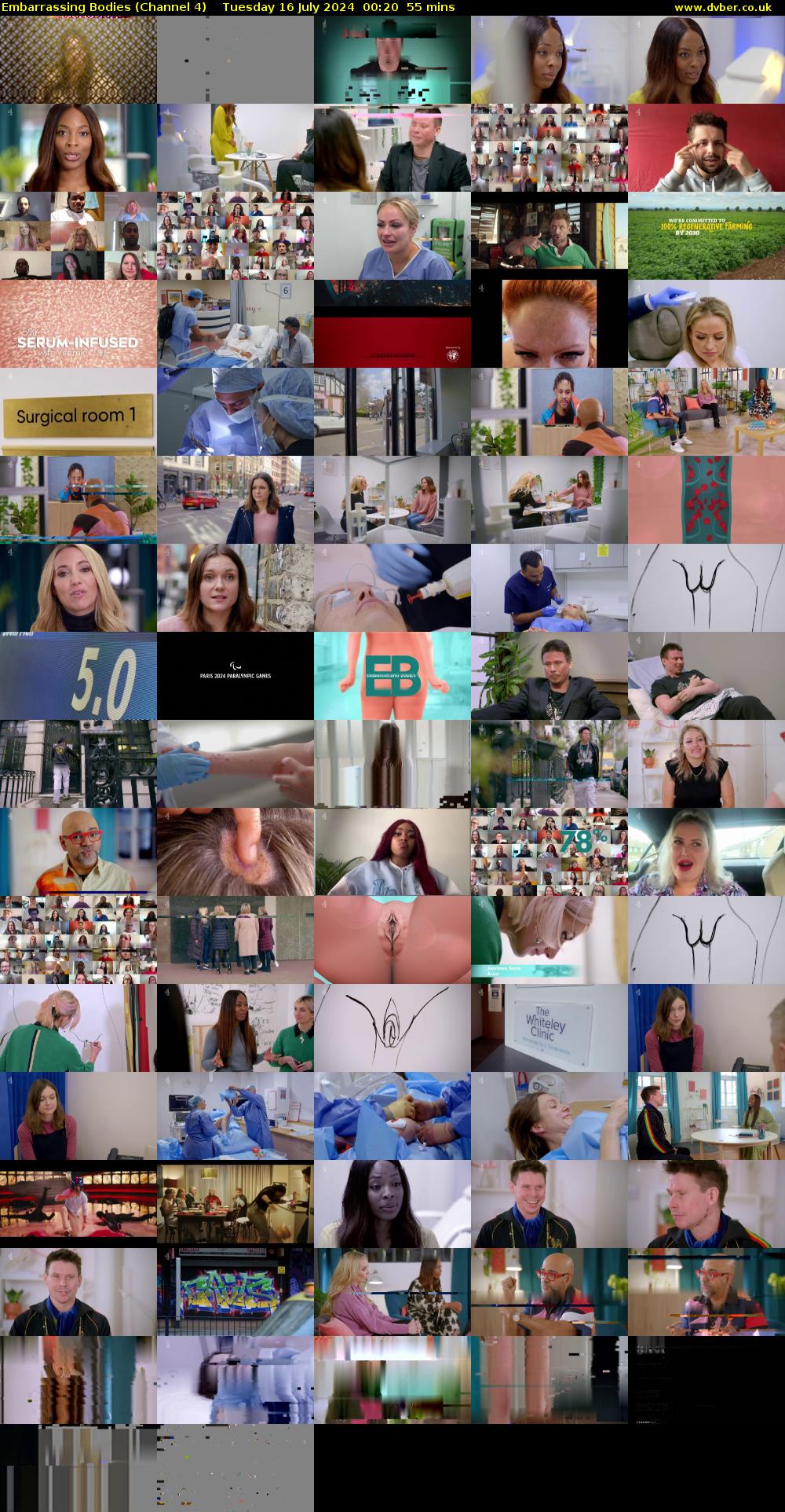 Embarrassing Bodies (Channel 4) Tuesday 16 July 2024 00:20 - 01:15