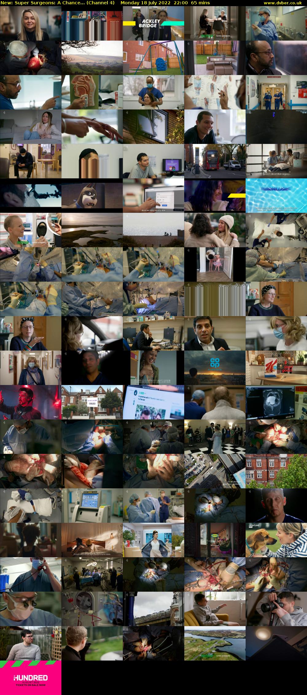 Super Surgeons: A Chance... (Channel 4) Monday 18 July 2022 22:00 - 23:05