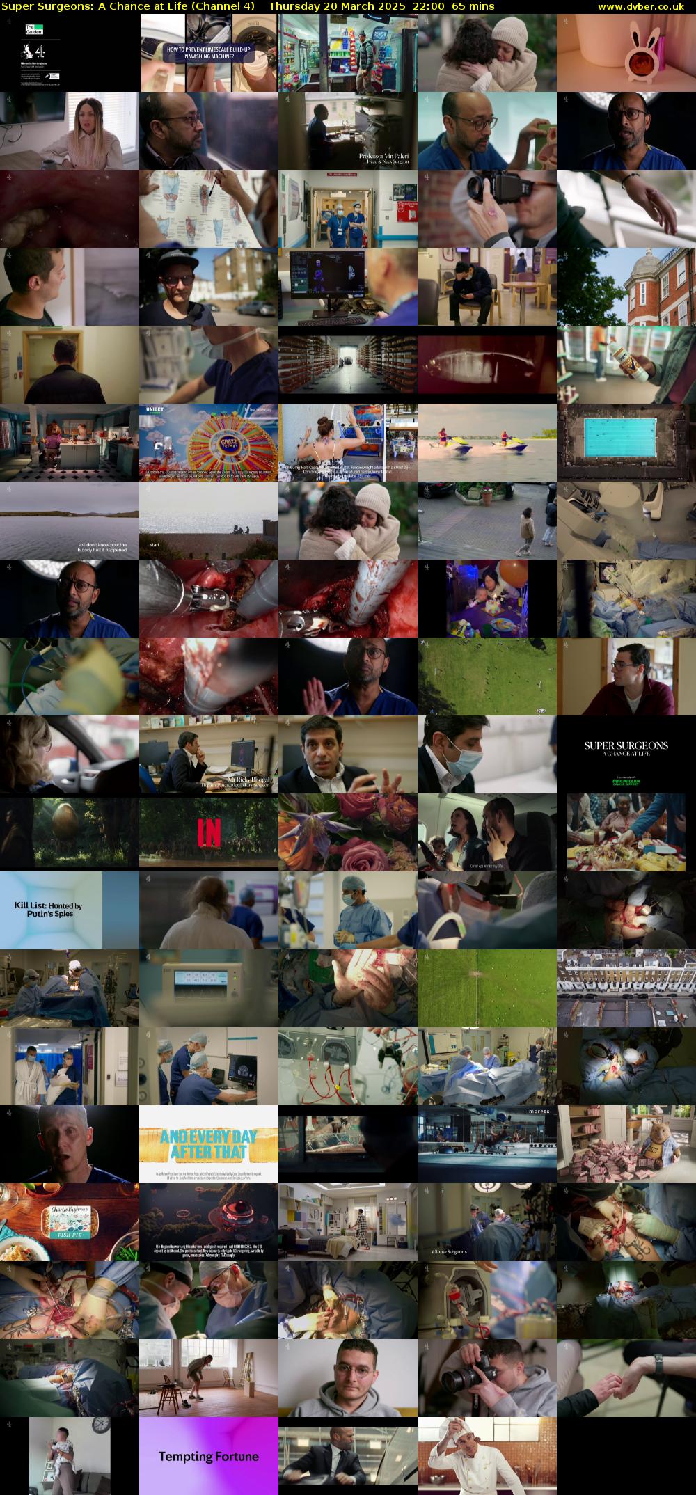 Super Surgeons: A Chance at Life (Channel 4) Thursday 20 March 2025 22:00 - 23:05