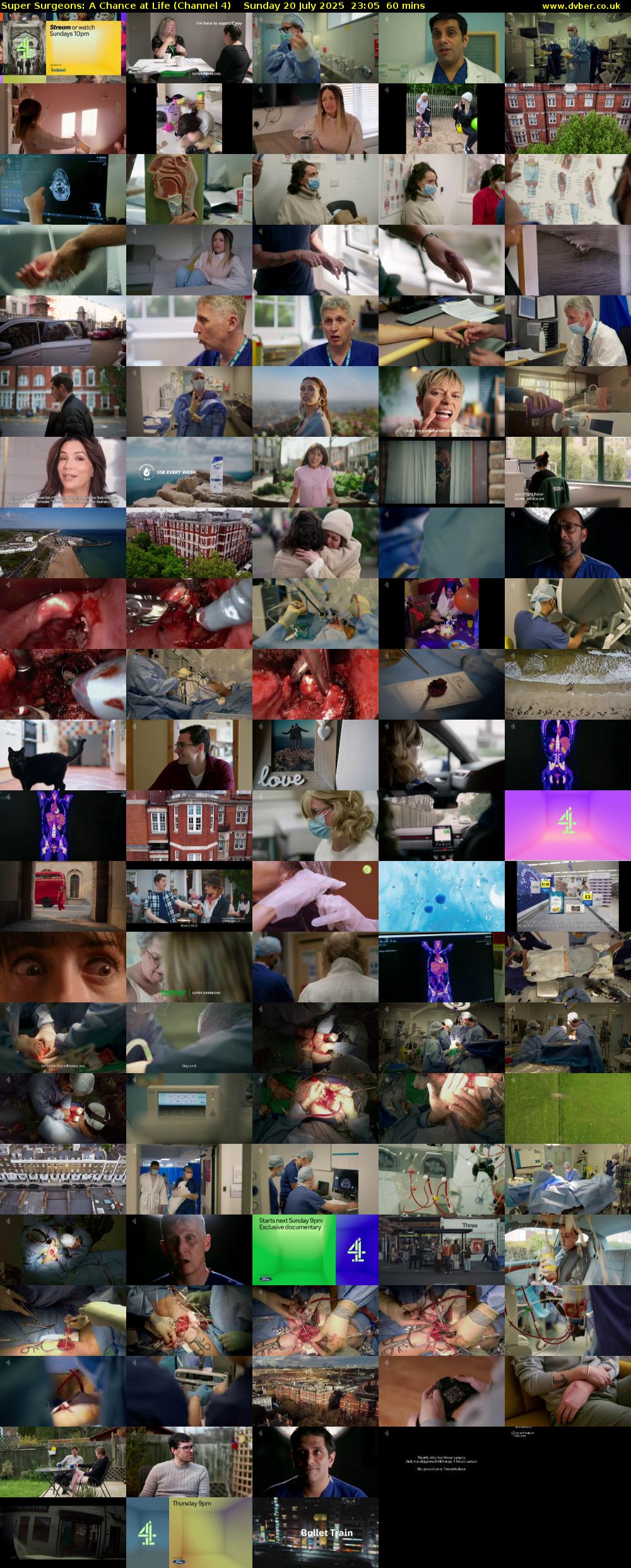 Super Surgeons: A Chance at Life (Channel 4) Sunday 20 July 2025 23:05 - 00:05