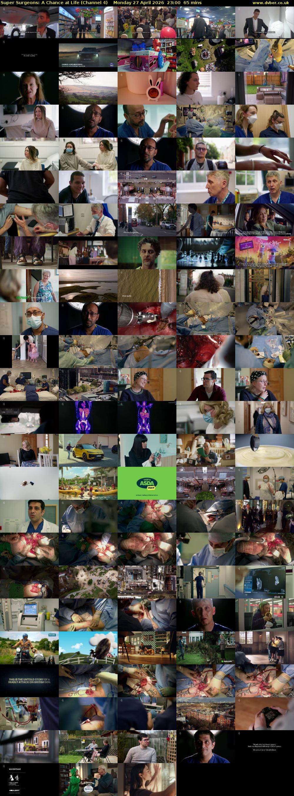 Super Surgeons: A Chance at Life (Channel 4) Monday 27 April 2026 23:00 - 00:05