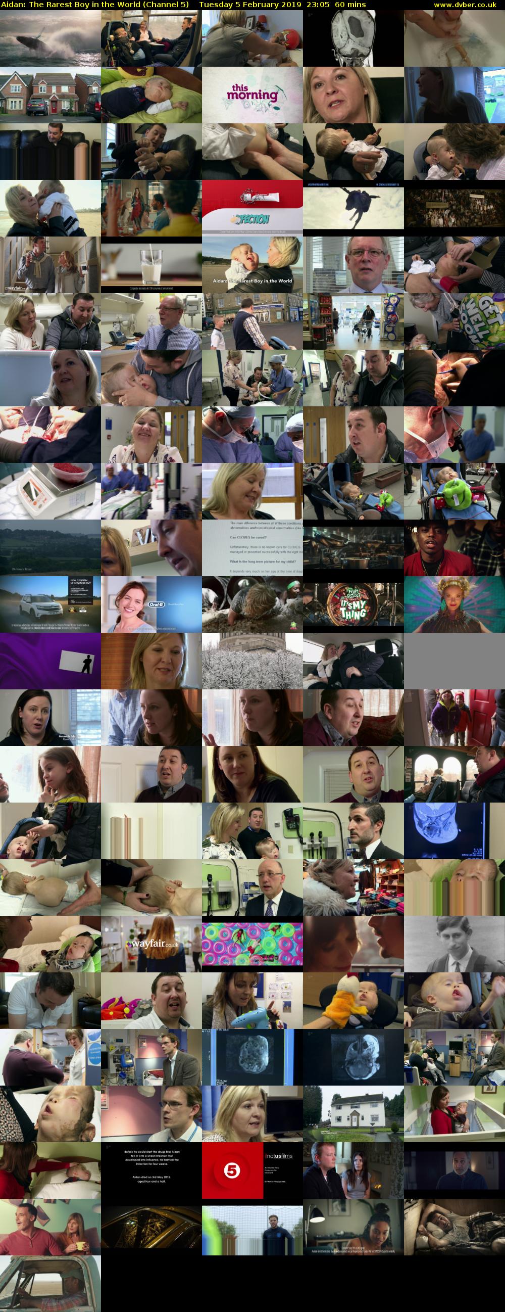 Aidan: The Rarest Boy in the World (Channel 5) Tuesday 5 February 2019 23:05 - 00:05