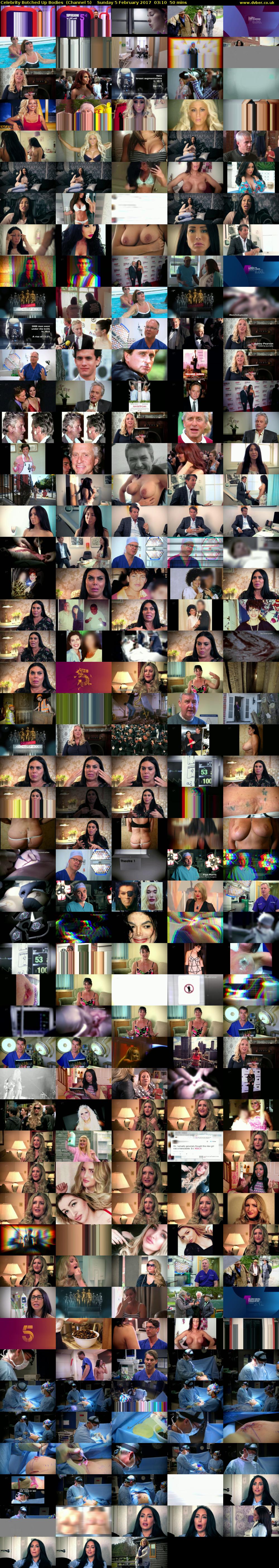 Celebrity Botched Up Bodies  (Channel 5) Sunday 5 February 2017 03:10 - 04:00