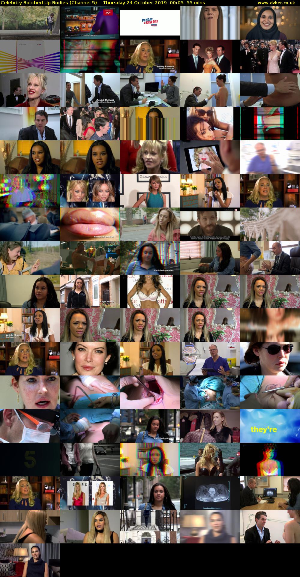 Celebrity Botched Up Bodies (Channel 5) Thursday 24 October 2019 00:05 - 01:00