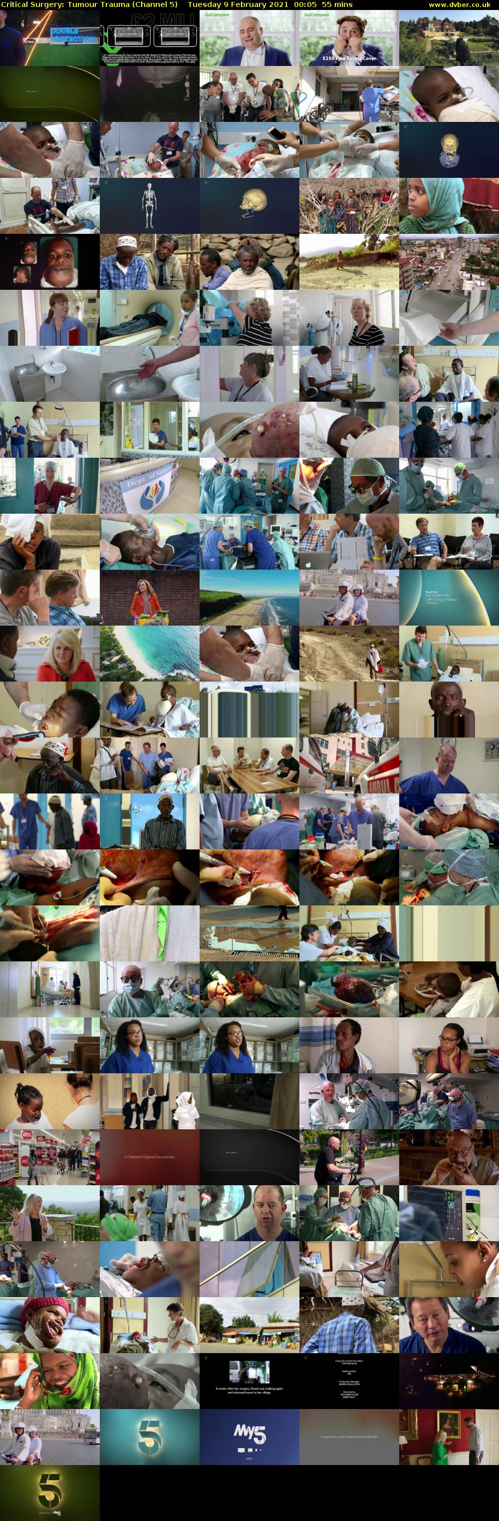 Critical Surgery: Tumour Trauma (Channel 5) Tuesday 9 February 2021 00:05 - 01:00