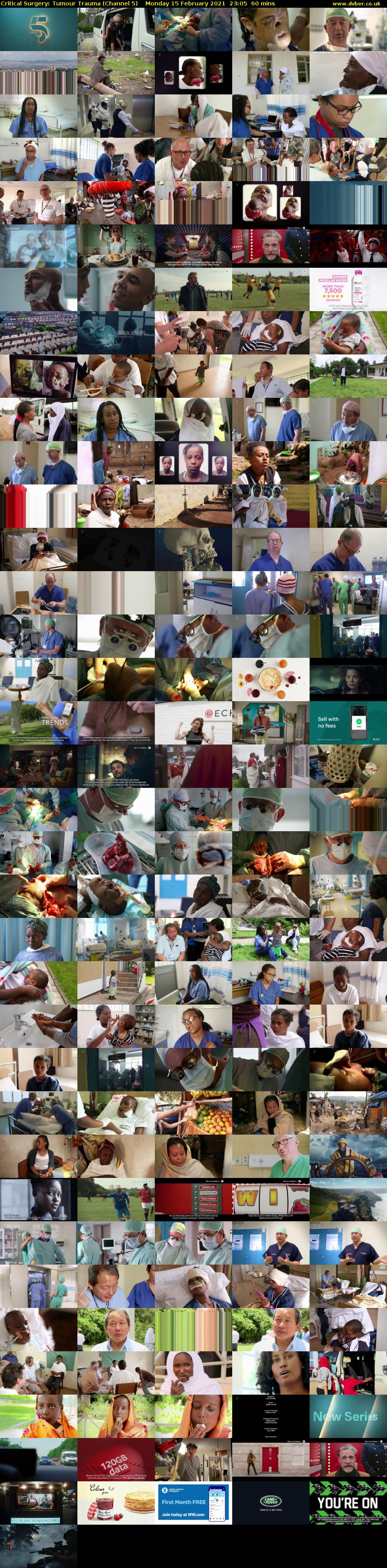 Critical Surgery: Tumour Trauma (Channel 5) Monday 15 February 2021 23:05 - 00:05