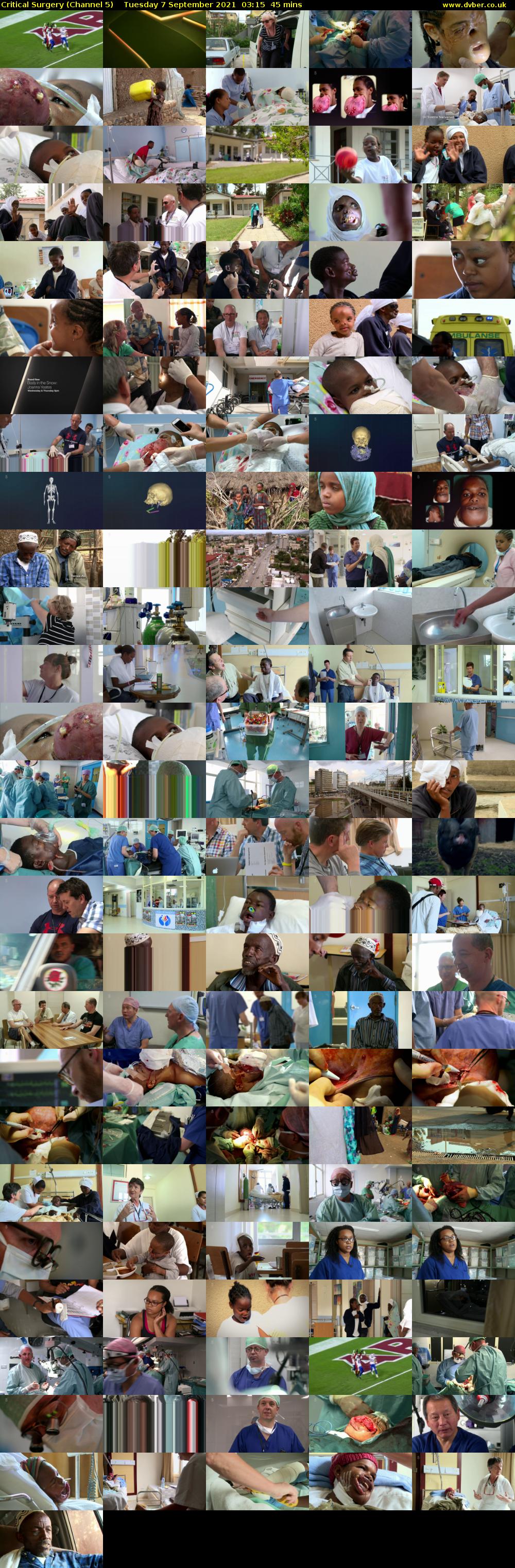Critical Surgery (Channel 5) Tuesday 7 September 2021 03:15 - 04:00