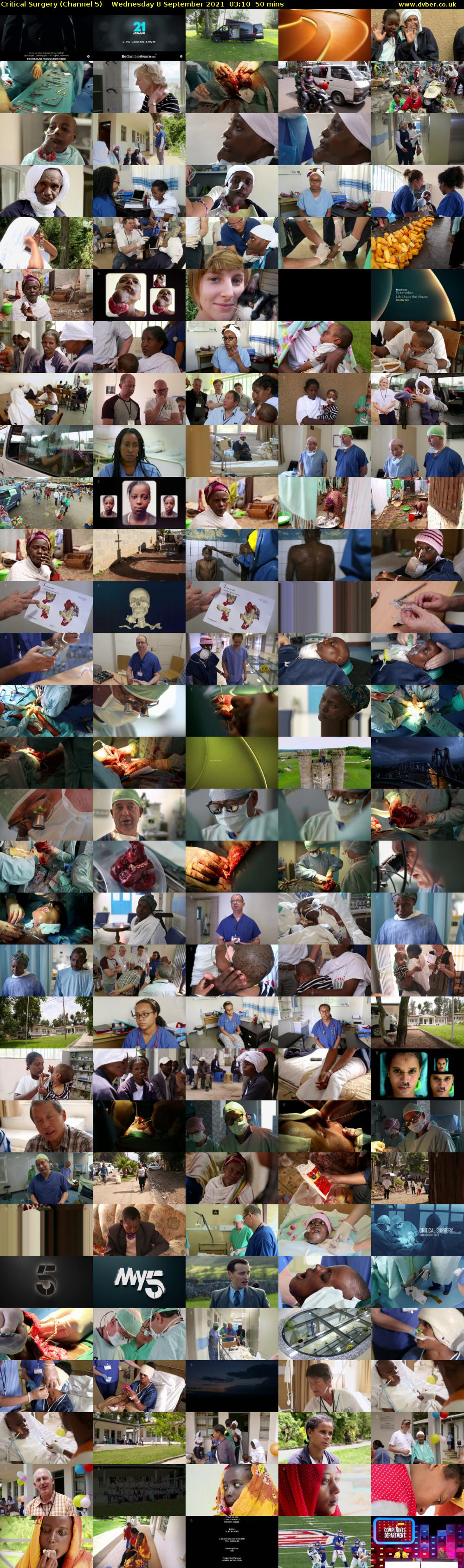 Critical Surgery (Channel 5) Wednesday 8 September 2021 03:10 - 04:00
