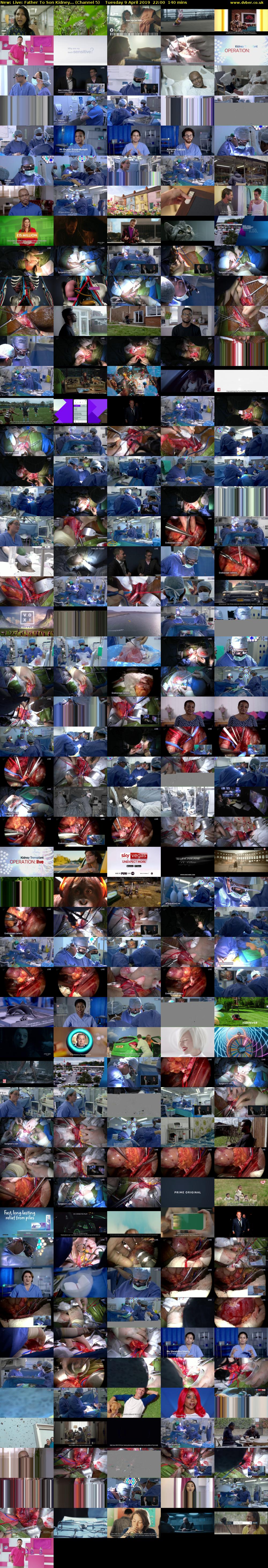 Live: Father To Son Kidney... (Channel 5) Tuesday 9 April 2019 22:00 - 00:20