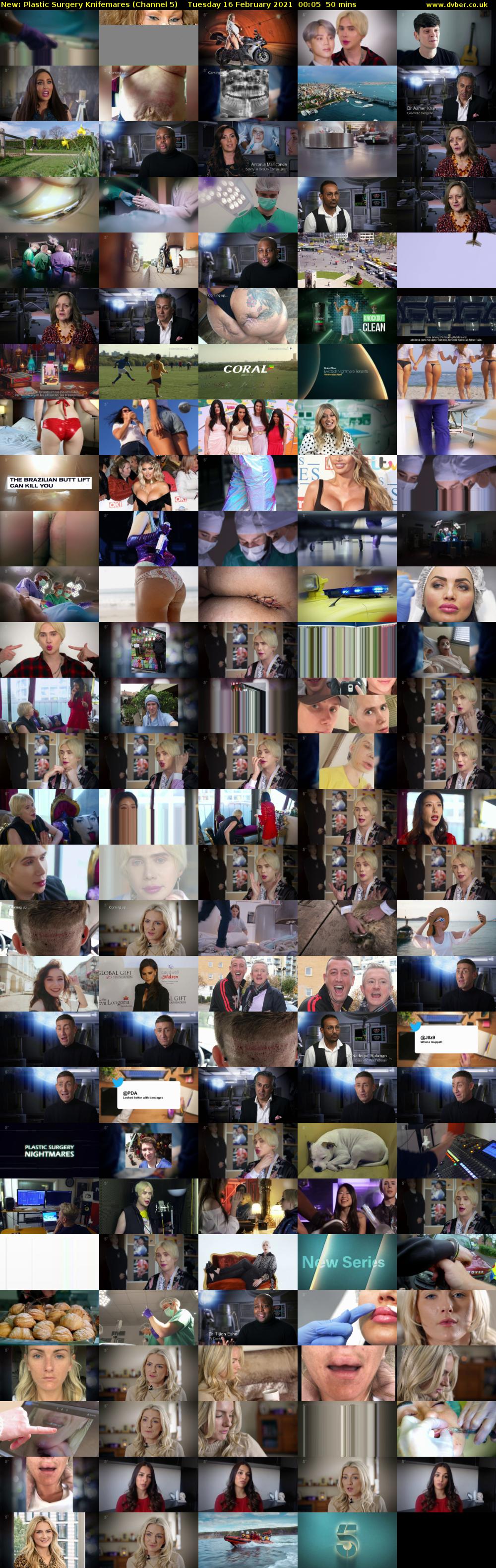 Plastic Surgery Knifemares (Channel 5) Tuesday 16 February 2021 00:05 - 00:55