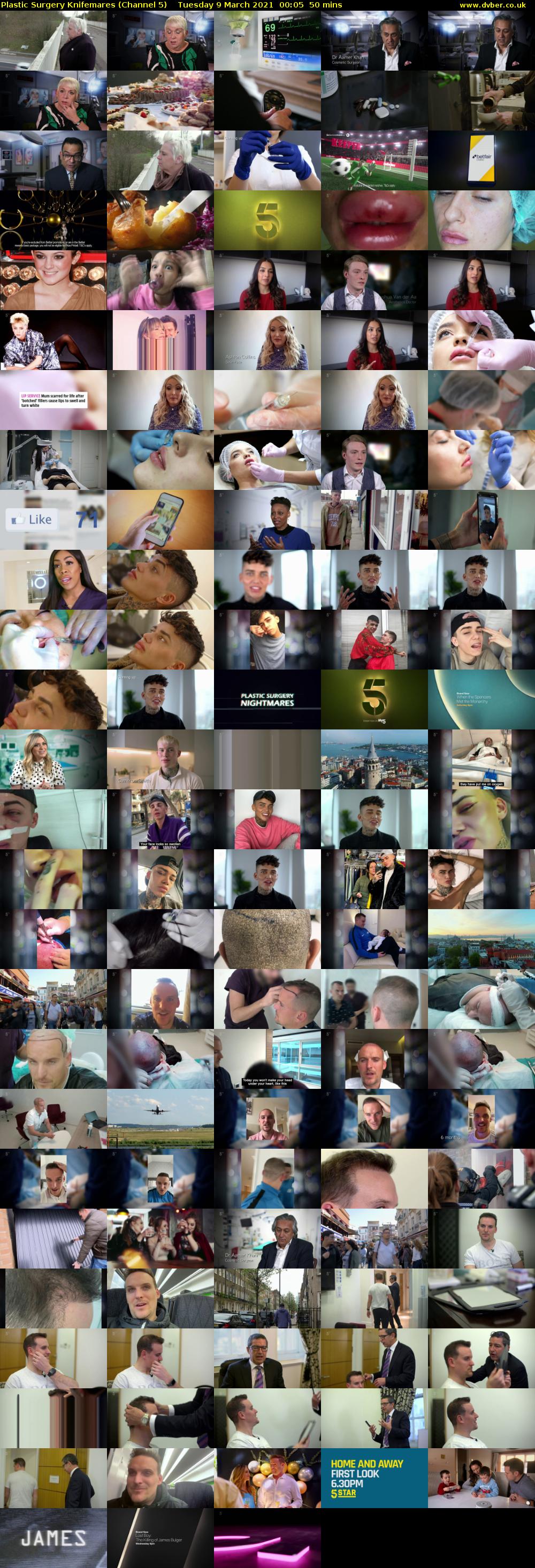 Plastic Surgery Knifemares (Channel 5) Tuesday 9 March 2021 00:05 - 00:55