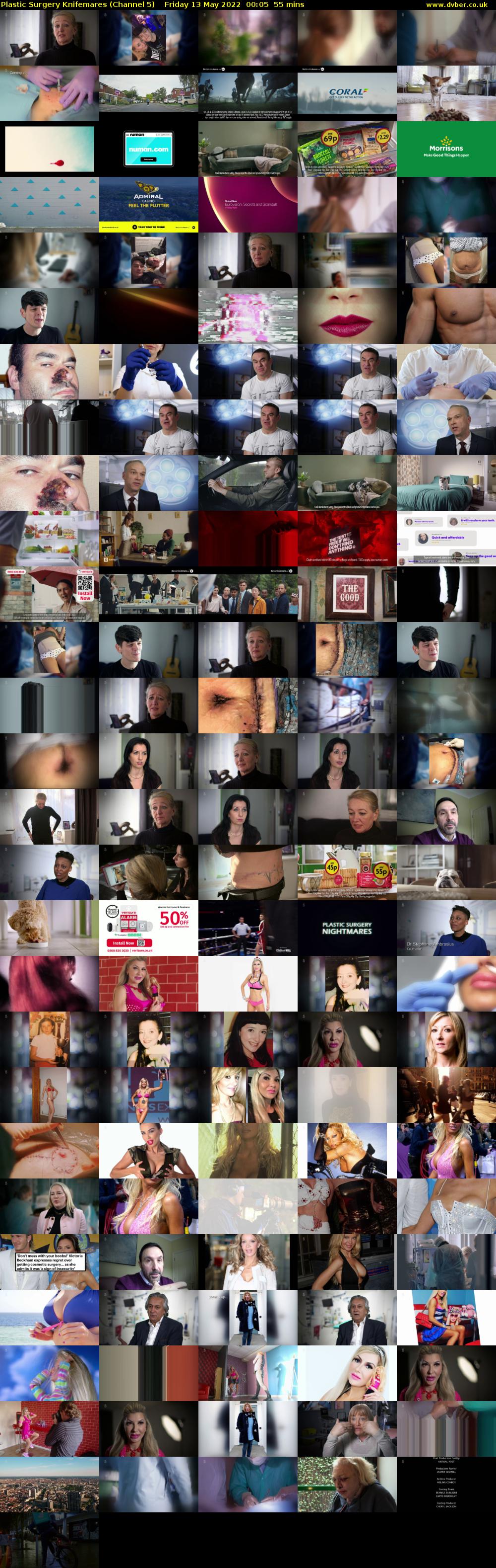 Plastic Surgery Knifemares (Channel 5) Friday 13 May 2022 00:05 - 01:00