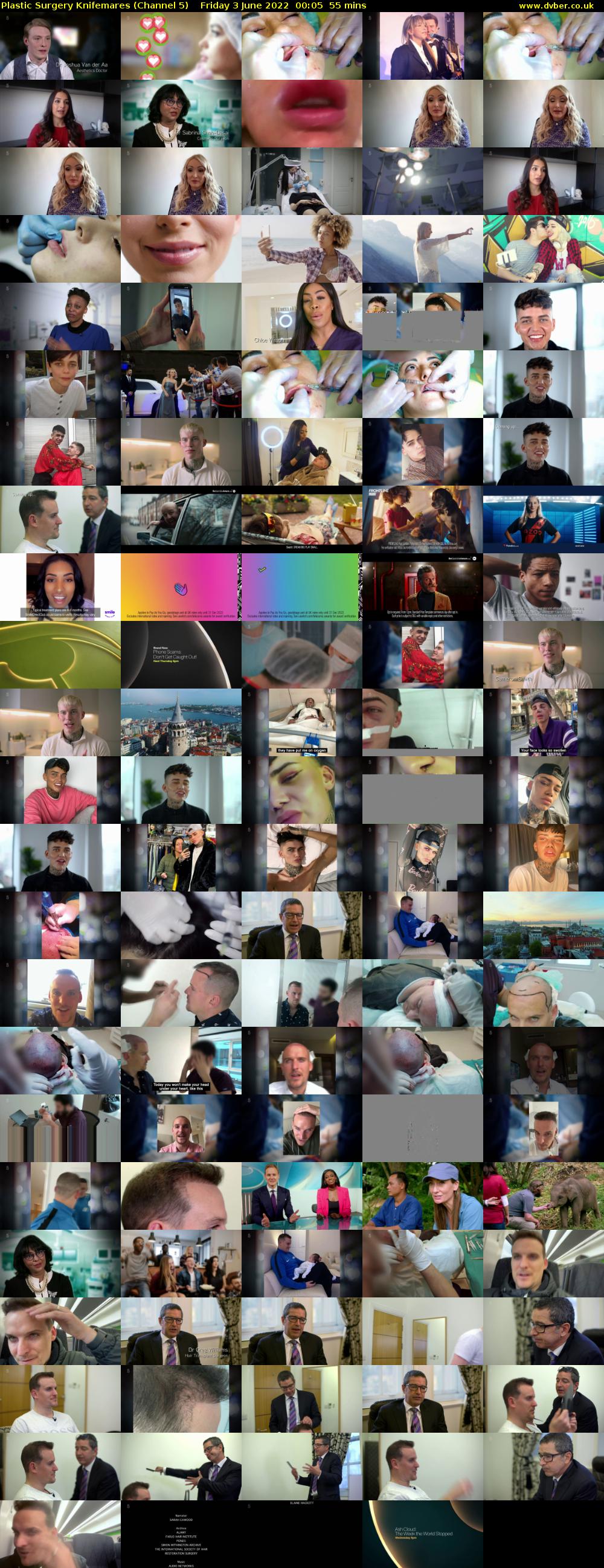 Plastic Surgery Knifemares (Channel 5) Friday 3 June 2022 00:05 - 01:00