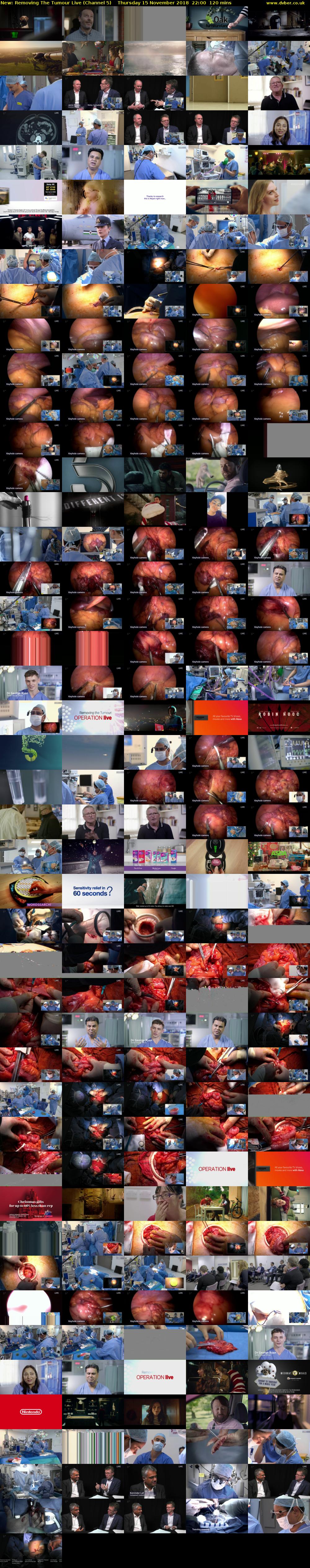 Removing The Tumour Live (Channel 5) Thursday 15 November 2018 22:00 - 00:00
