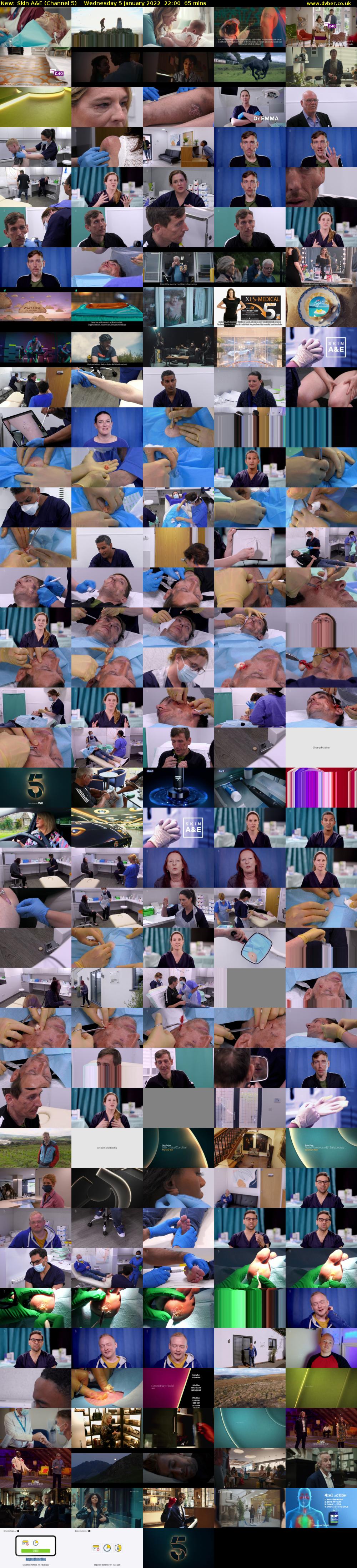 Skin A&E (Channel 5) Wednesday 5 January 2022 22:00 - 23:05