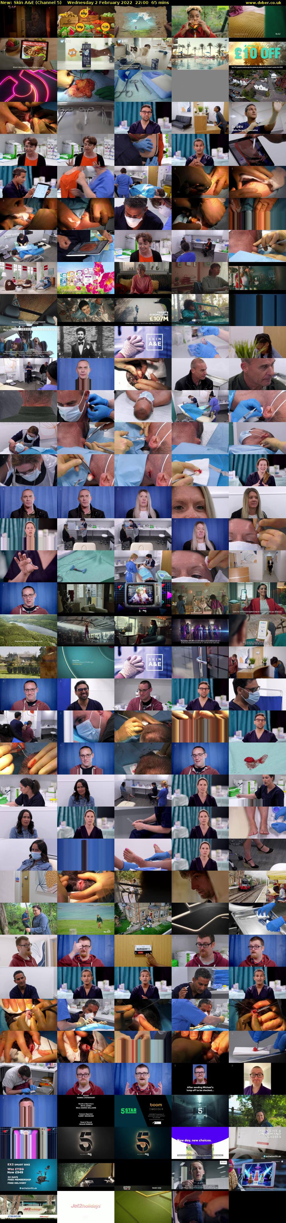 Skin A&E (Channel 5) Wednesday 2 February 2022 22:00 - 23:05