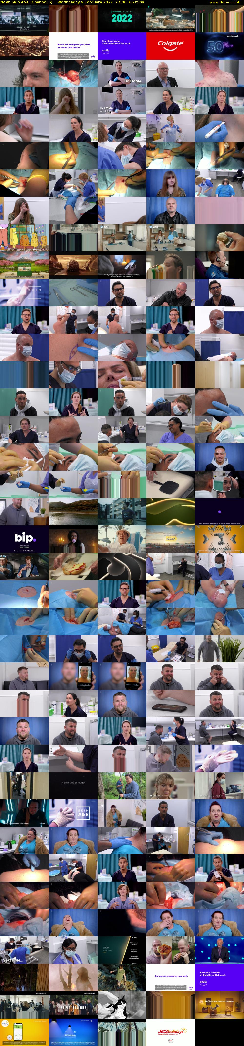 Skin A&E (Channel 5) Wednesday 9 February 2022 22:00 - 23:05