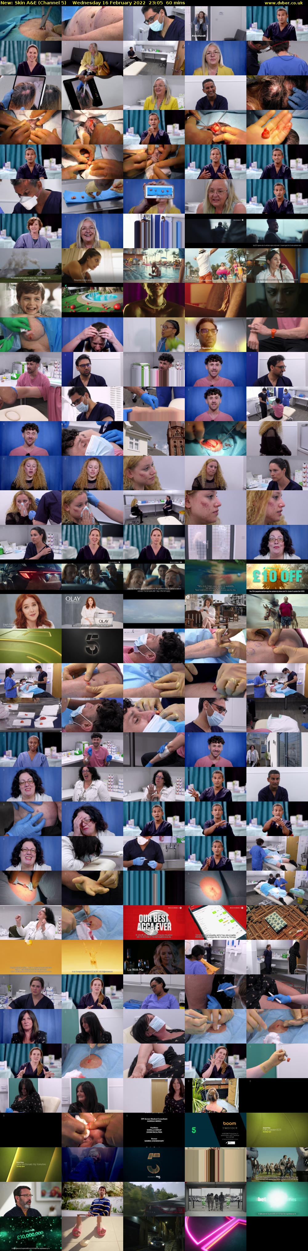 Skin A&E (Channel 5) Wednesday 16 February 2022 23:05 - 00:05
