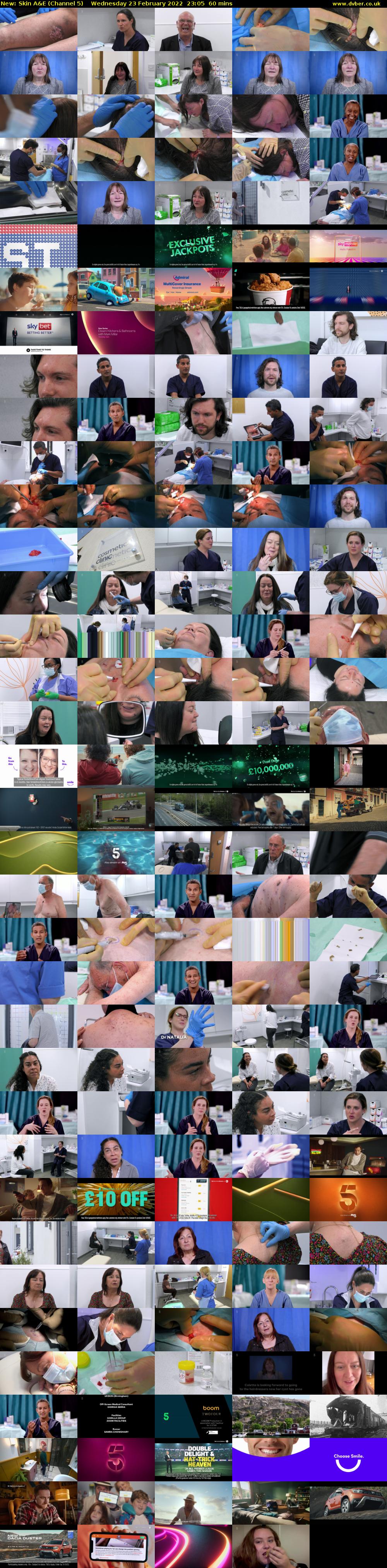 Skin A&E (Channel 5) Wednesday 23 February 2022 23:05 - 00:05