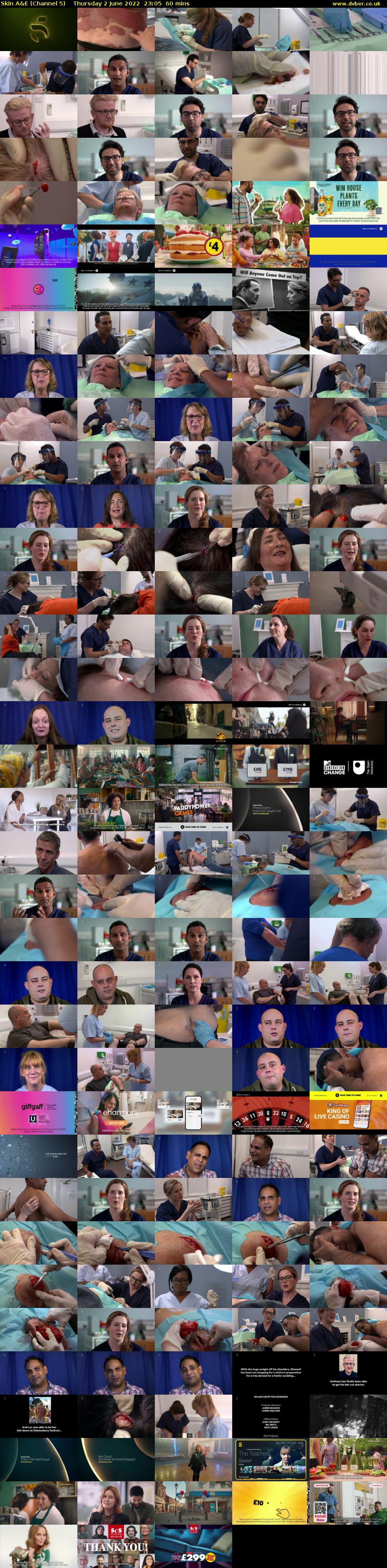 Skin A&E (Channel 5) Thursday 2 June 2022 23:05 - 00:05