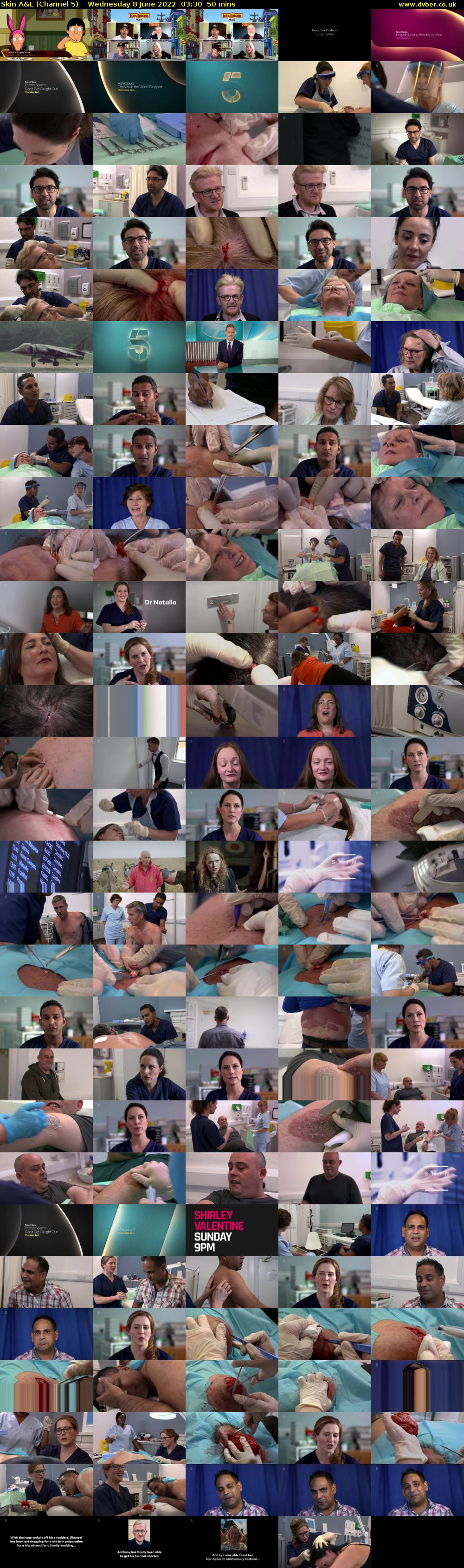 Skin A&E (Channel 5) Wednesday 8 June 2022 03:30 - 04:20