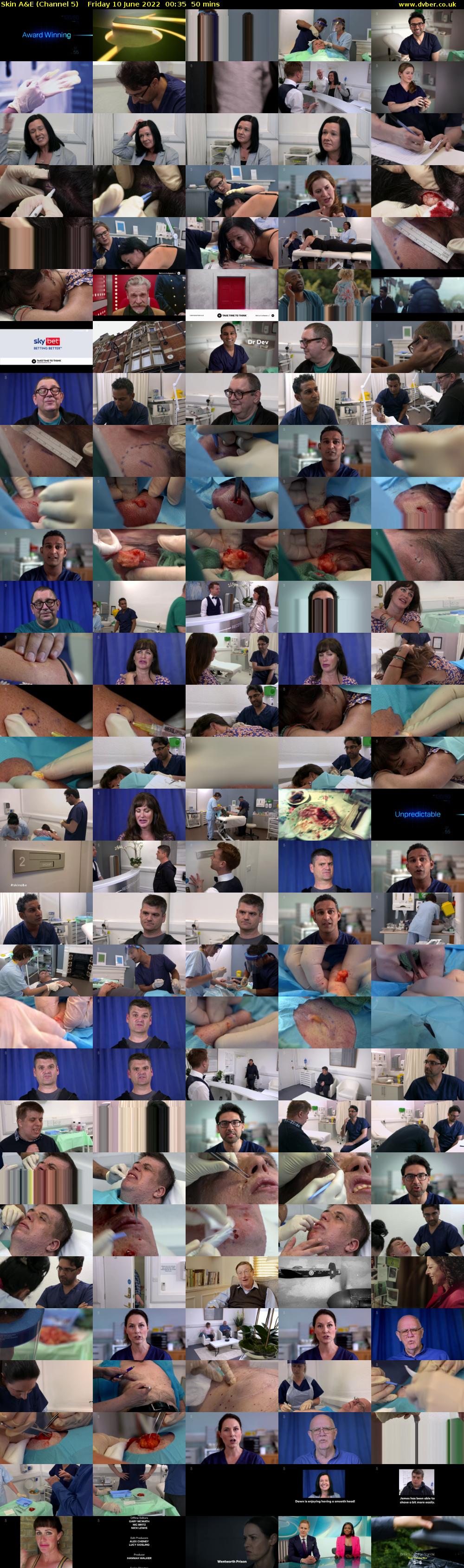 Skin A&E (Channel 5) Friday 10 June 2022 00:35 - 01:25