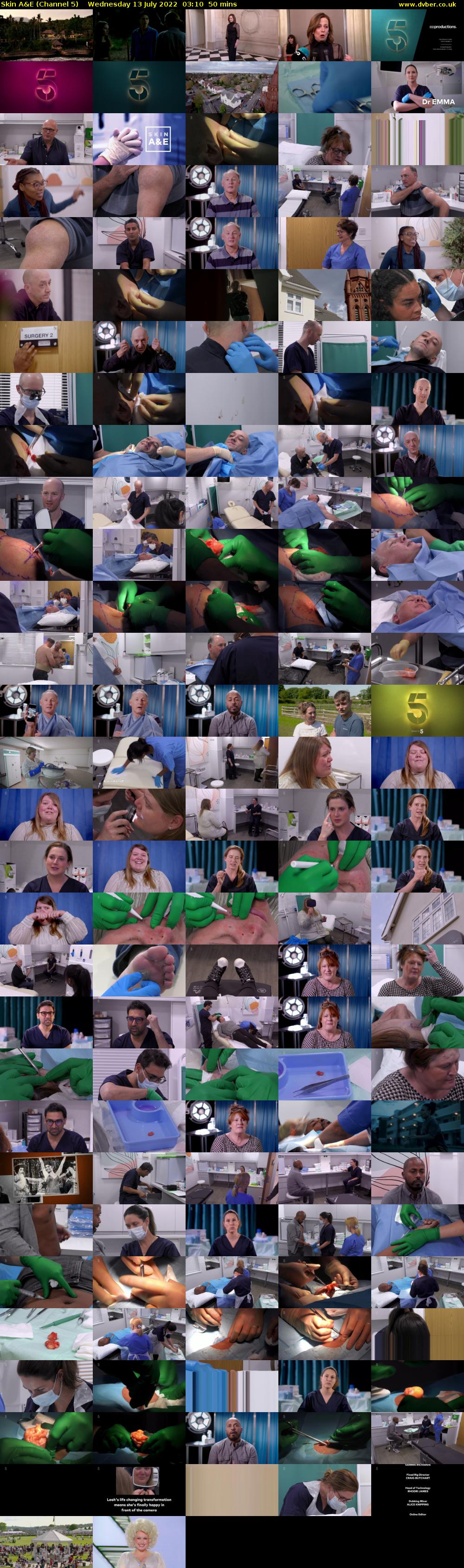 Skin A&E (Channel 5) Wednesday 13 July 2022 03:10 - 04:00