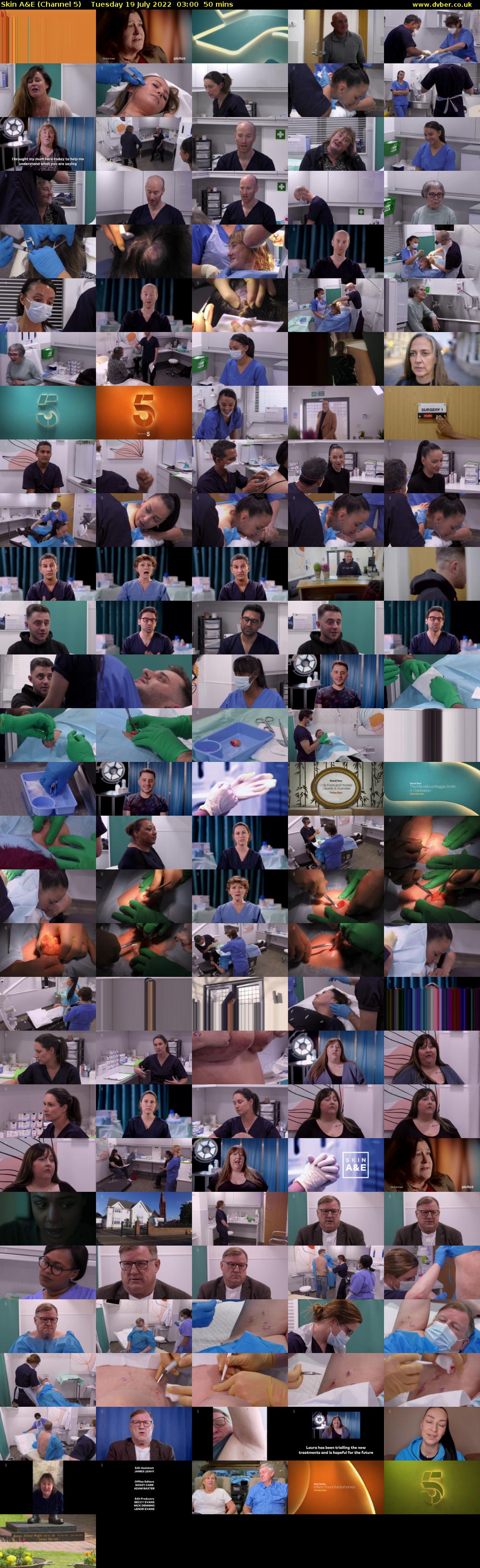 Skin A&E (Channel 5) Tuesday 19 July 2022 03:00 - 03:50
