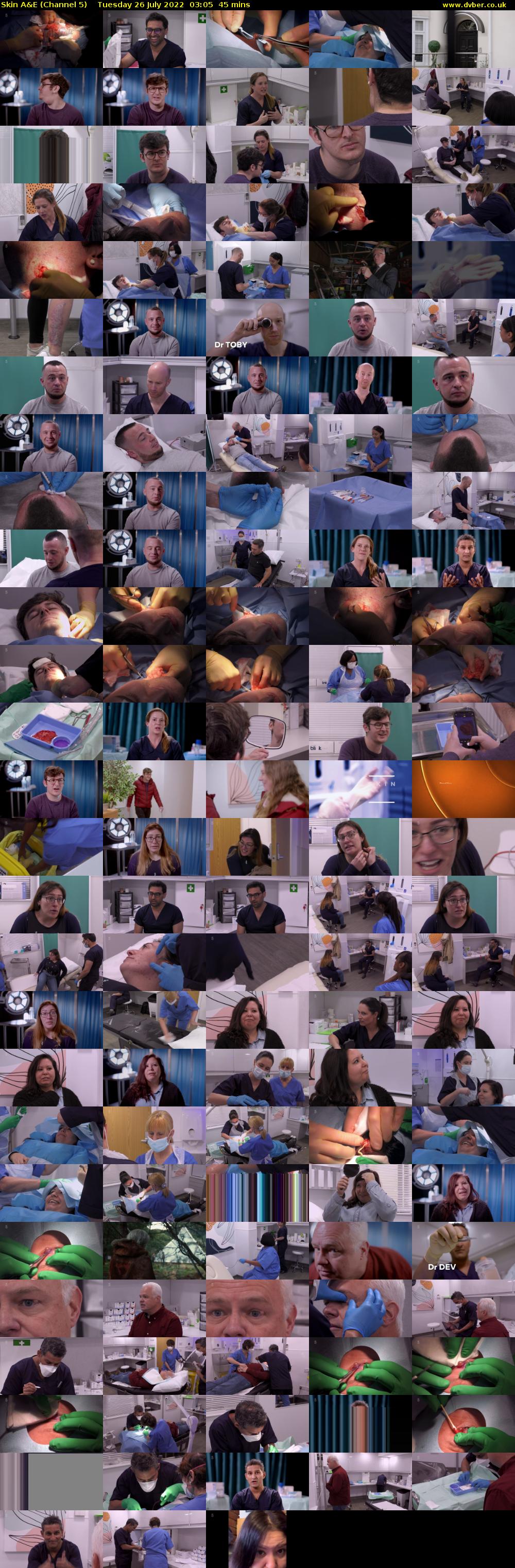 Skin A&E (Channel 5) Tuesday 26 July 2022 03:05 - 03:50
