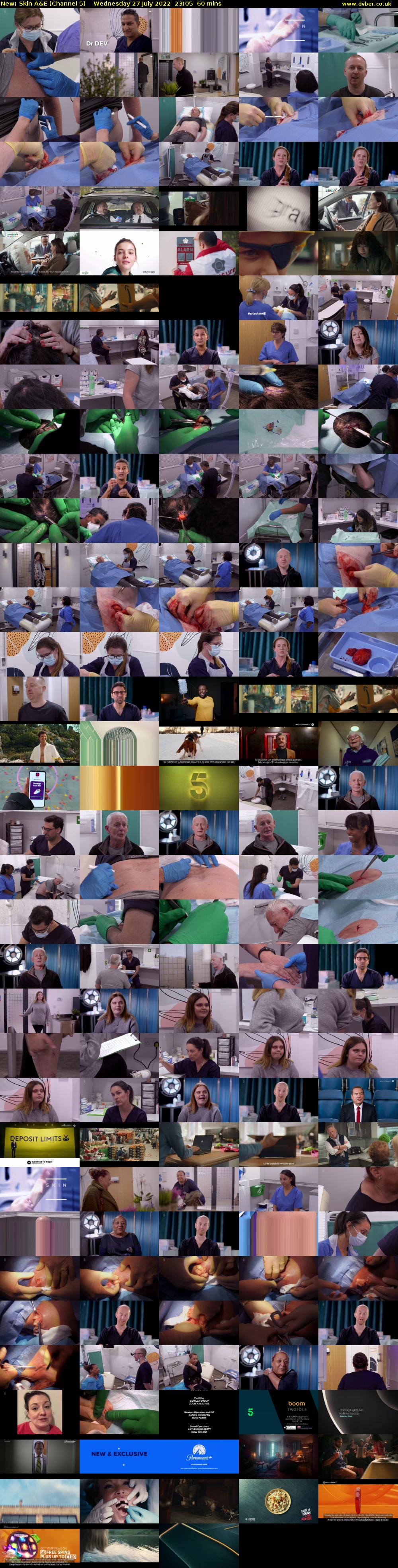 Skin A&E (Channel 5) Wednesday 27 July 2022 23:05 - 00:05