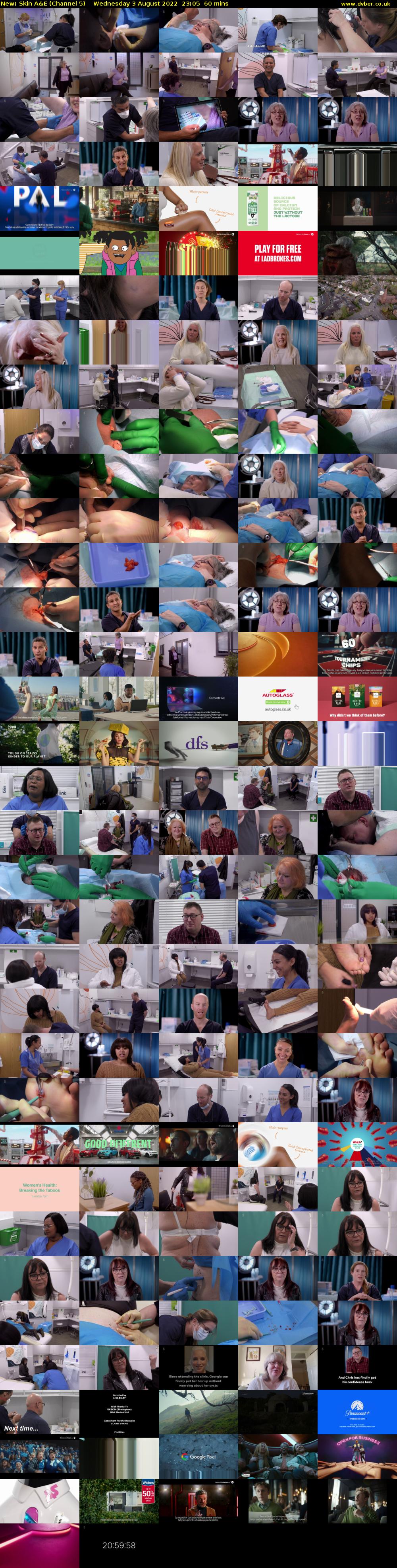 Skin A&E (Channel 5) Wednesday 3 August 2022 23:05 - 00:05