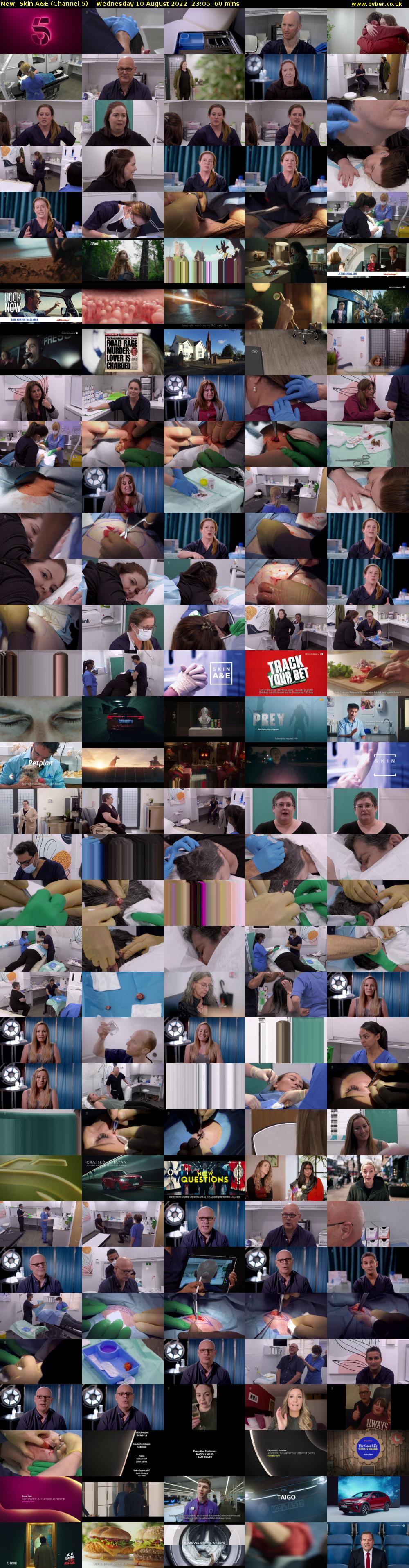 Skin A&E (Channel 5) Wednesday 10 August 2022 23:05 - 00:05
