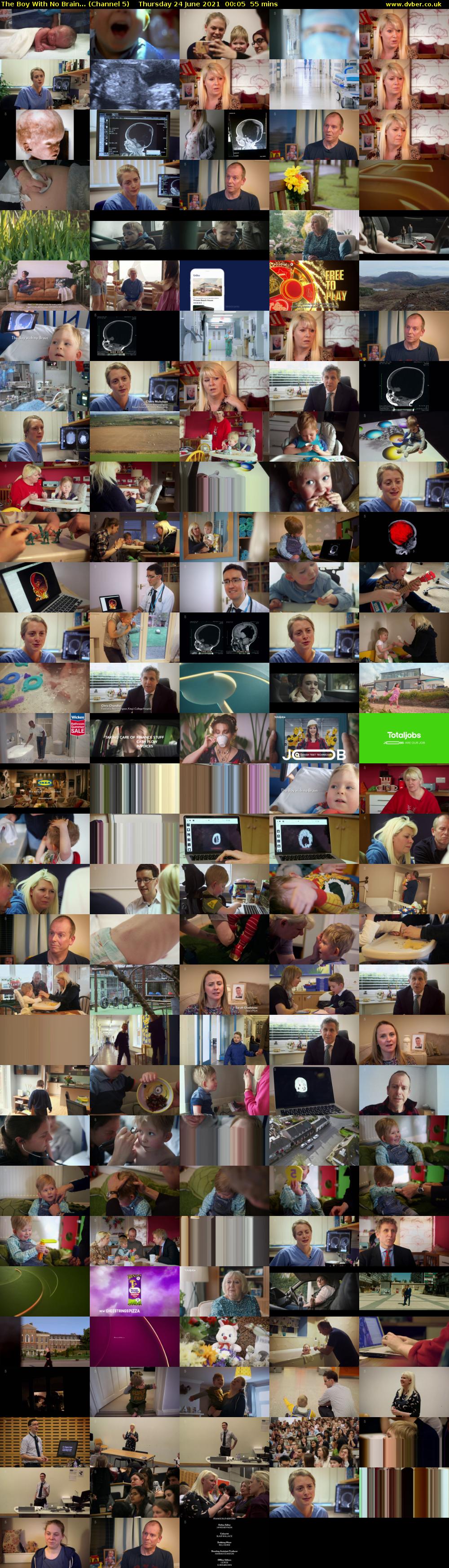 The Boy With No Brain... (Channel 5) Thursday 24 June 2021 00:05 - 01:00