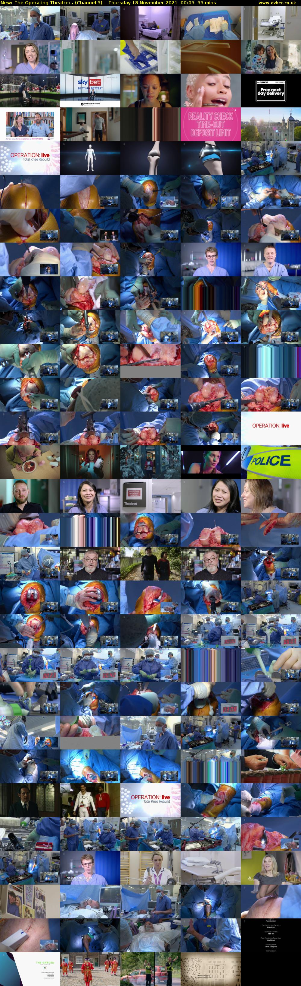 The Operating Theatre:.. (Channel 5) Thursday 18 November 2021 00:05 - 01:00