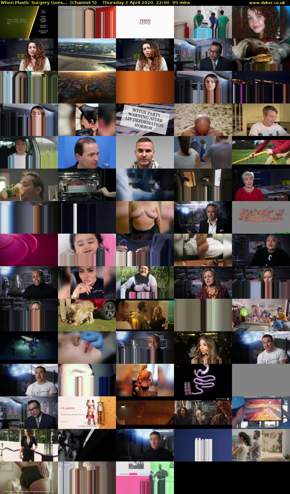 When Plastic Surgery Goes...  (Channel 5) Thursday 2 April 2020 22:00 - 23:35