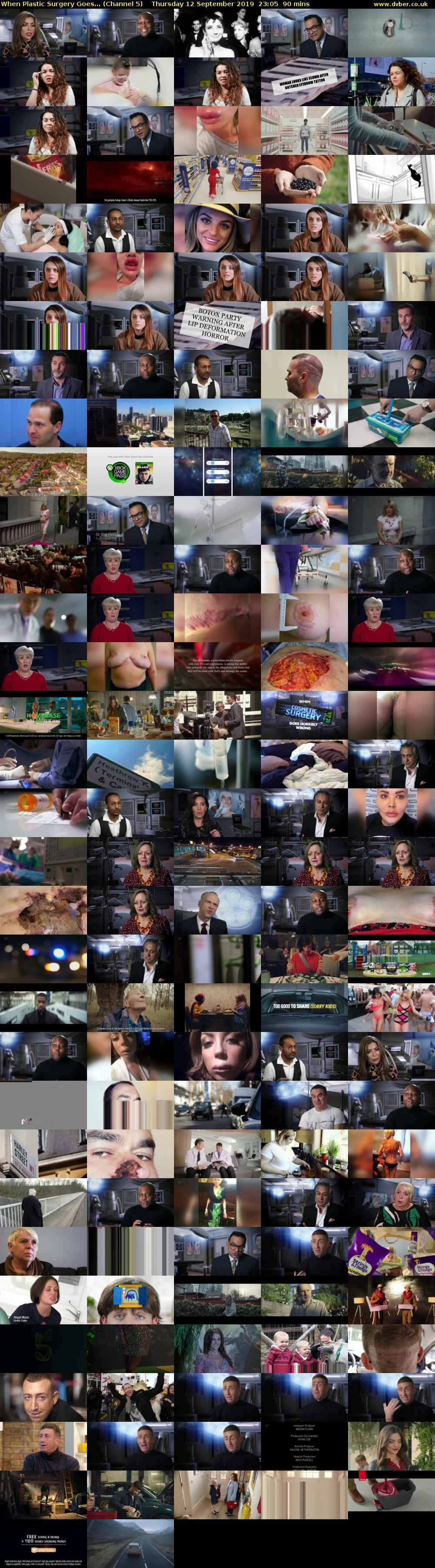 When Plastic Surgery Goes... (Channel 5) Thursday 12 September 2019 23:05 - 00:35