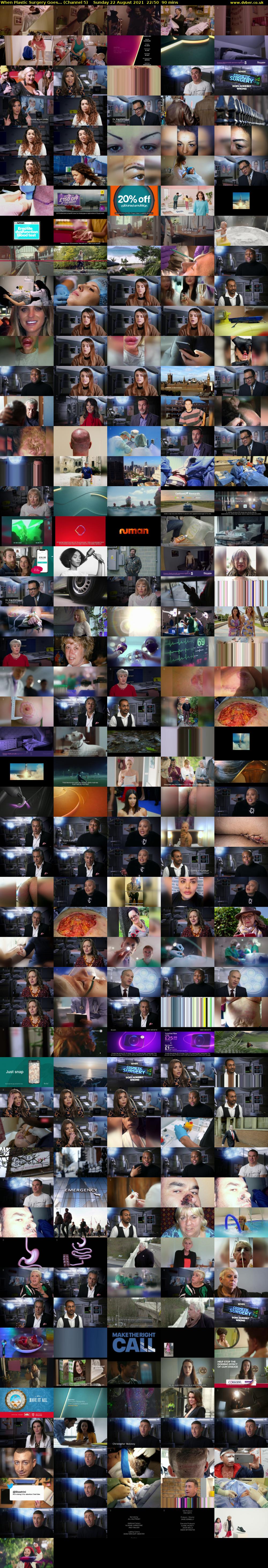 When Plastic Surgery Goes... (Channel 5) Sunday 22 August 2021 22:50 - 00:20