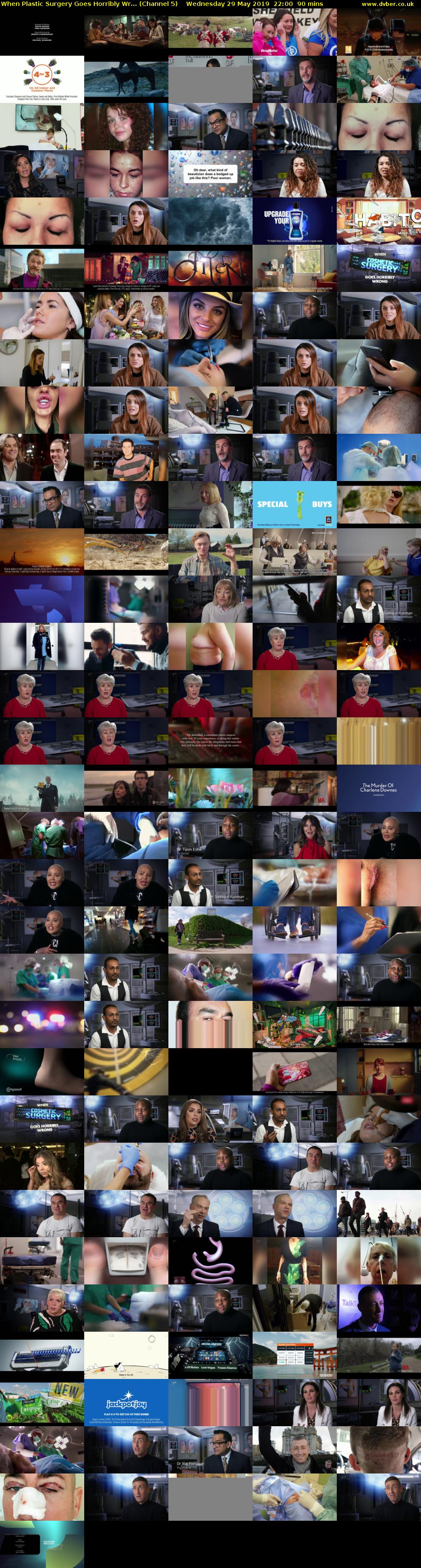 When Plastic Surgery Goes Horribly Wr... (Channel 5) Wednesday 29 May 2019 22:00 - 23:30