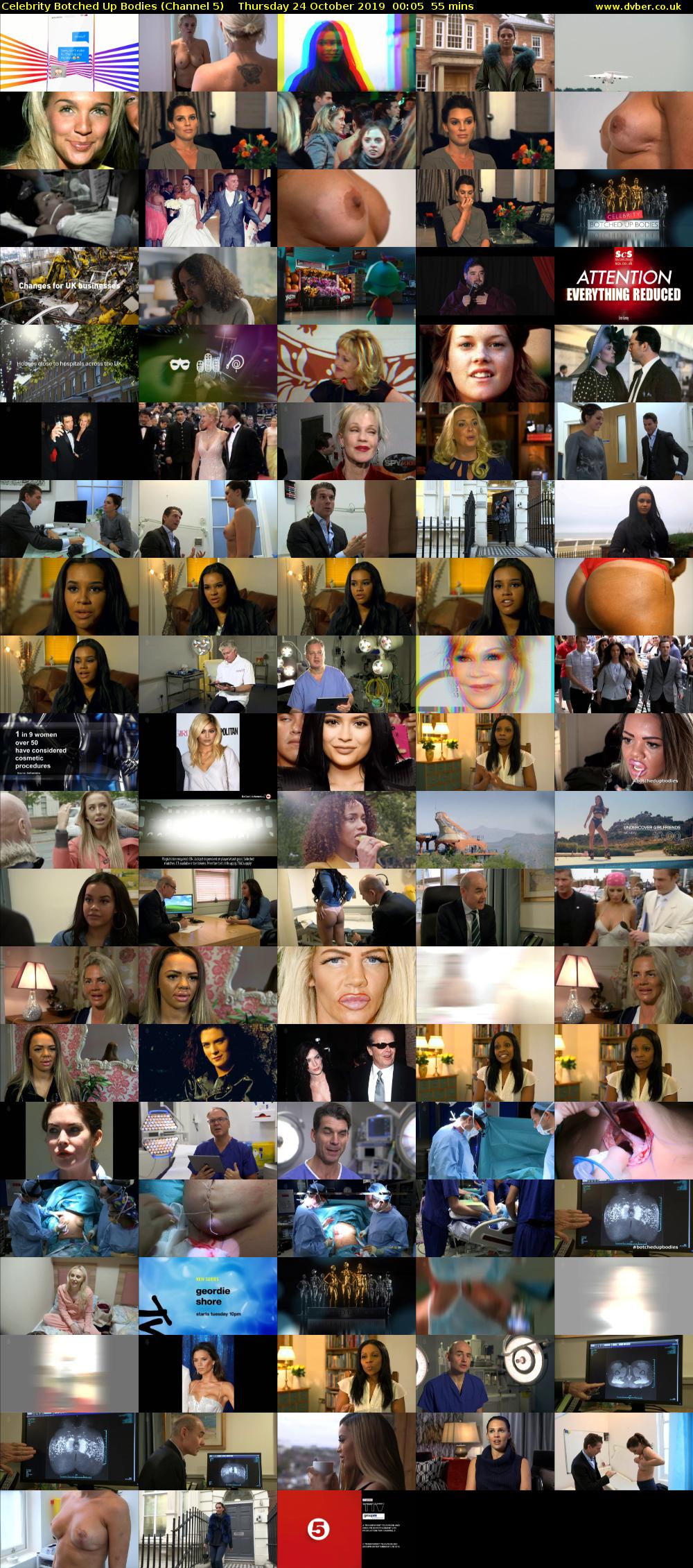 Celebrity Botched Up Bodies (Channel 5) Thursday 24 October 2019 00:05 - 01:00