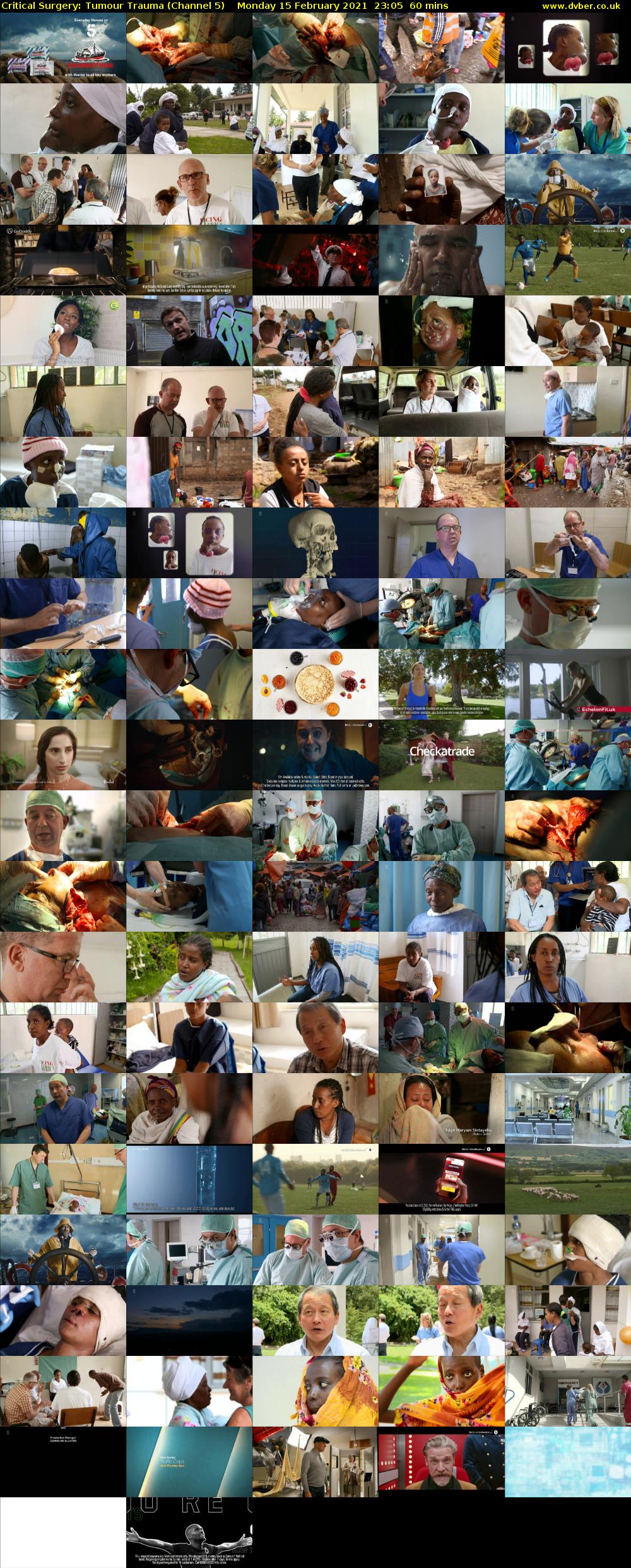 Critical Surgery: Tumour Trauma (Channel 5) Monday 15 February 2021 23:05 - 00:05