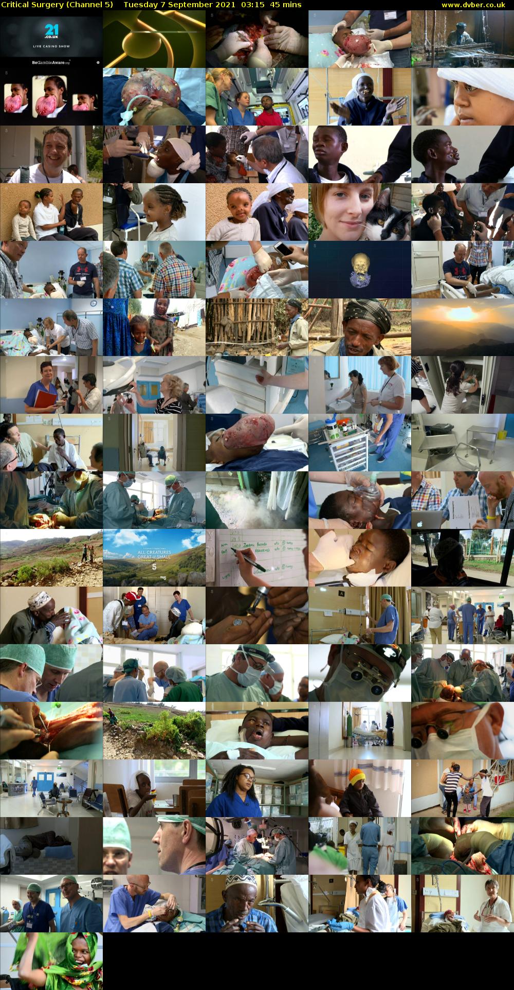 Critical Surgery (Channel 5) Tuesday 7 September 2021 03:15 - 04:00