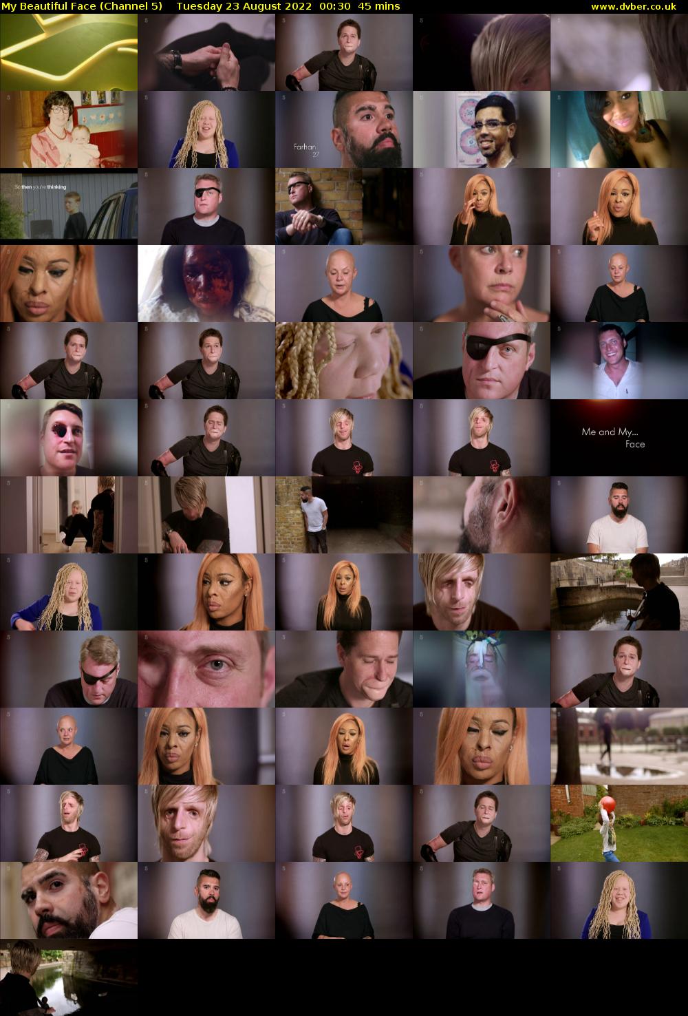 My Beautiful Face (Channel 5) Tuesday 23 August 2022 00:30 - 01:15